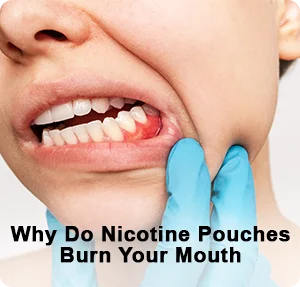 Why Do Nicotine Pouches Burn Your Mouth?